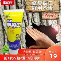 Heavy hand crack hand cream for women Dry crack dry rough hand crack itchy blisters peeling summer men