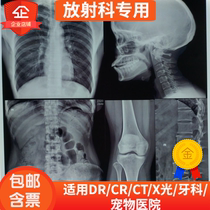 Blue-based inkjet high-definition medical Film Radiology orthopedic film X-Ray DR CT magnetic resonance dry film