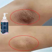 Joint knee elbow elbow black dead skin exfoliating whitening artifact neck underarm to melanin White