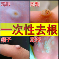 Corns corns corns corns corns corns corns corns corns corns corns corns corns corns corns corns corns corns