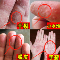 Snake oil ointment Horse oil ointment Anti-chapped heel cracks Seasonal hand peeling repair cream Chapped hands Cracked hands and feet cracked