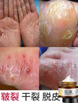 Little Red Book recommends cracked hands and feet cracked cracked heels cracked horse oil hand cream foot care buy