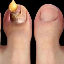 (Major bloggers plant grass) (drop a drop) A clean bad A repaired