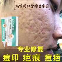 Nanjing Tong Ren Tang scar net care Scar ointment surgery hyperplasia bump pimple Pox pit pox print official online shop