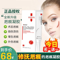 Smiling Weijing Weiwei official website Baweijing to repair set hyperplasia of acne acne after scar removal