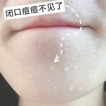 (Küchens recommendation to remove the face 99% dirty things) facial cleansing pores face de-mite Ginseng soap