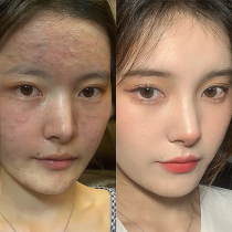 (Brush the acid pores disappear) Let the pores discharge the dirt like sand to remove the facial pores.