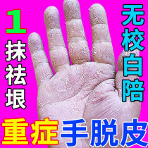 Hand peeling repair cream Hand molting Seasonal finger peeling cracking burst skin Hand peeling dry palm chapped