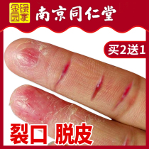 Hand finger cracked opening sub cracked peeling cracking open and dry cracked healing cream hand cream hand foot and hands and feet Cracked Repair