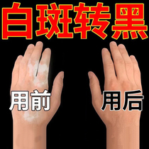 White spot cover liquid vitiligo concealer pen hand facial skin special waterproof and anti-sweat persistent cover artifact