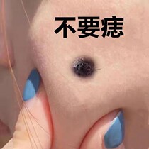 Removal of all black spots on the face Spots Finish without scar melanin Net Yan Beauty Essential Oils for Men and Women