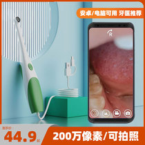 Childrens mobile phone Oral endoscopic teeth Endoscopy Visualizer Home Care High Definition Photo-Camera Examination Probe