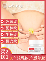 Pregnant women remove stretch marks postpartum elimination repair cream Olive oil prevention special obesity tightening skin care pregnancy pattern
