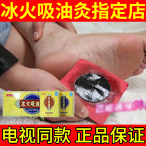  TV with the same ice and fire oil-absorbing moxibustion paste ice and fire oil-absorbing thin official flagship store Aunt Yang big stomach king oil-scraping soup