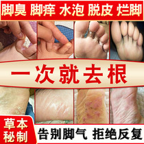Treatment of itching feet itching anti-itching antibacterial feet blistering peeling itching artifact foot bubble type foot bubble type beriberi itching ointment