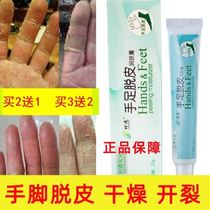 Finger peeling medicine Palm hand molt repair cream Palm hand peeling treatment hand dryness anti-itching repair female skin cream