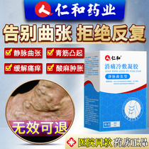 Renhe spermatic vein special varicose ointment treatment of legs External pulse Shu cold compress Medical drug gel earthworm legs