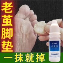 Foot dead skin calluses soles of feet removal of hand calluses hard skin cocoon softener toe joints cocoon artifact