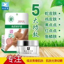 Chicken skin hair follicle keratinization removal of snakeskin fish scales leg disease dry skin skin cream cream
