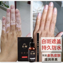 White spot covering liquid waterproof anti-sweat white wind concealer skin special covering artifact to remove white spot ointment repair