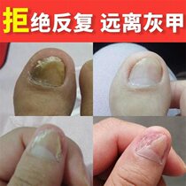 Buy 1 hair 2 Qin Yitang Huangs Fungus King official website Astragalus fungus King Wangs True Yin King