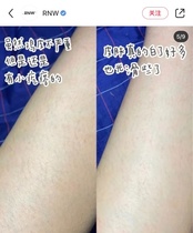 Chicken Skin Exfoliating Scrub 210 Green Red Deep Clean Full Body Female Back Acne