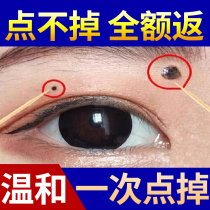 Moses to remove moles non-potions facial freckle artifact spotting water beauty salons removing moles non-marking pens