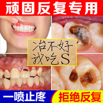 Tooth pain tooth pain pain relief quick-acting medicine gum swelling pain inflammation artifact stop wisdom tooth decay tooth decay spray