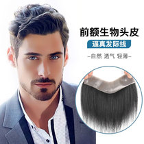 Hairline Mens wig Back Forehead Hair Restoration Bio Scalp Full real hair Head hair restoration block Male natural incognito
