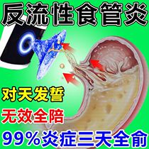 Gastroesophageal reflux inflammatory treatment gastritis conditioning stomach disease heartburn acid regurgitation belching bile Chinese medicine paste