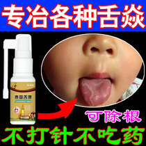 Map Tongue special effect spray tongue nipple inflammation tongue cleft tongue swelling numbness mouth sores blisters