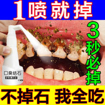 Male and female portable de-dental calculus mouthwash fungicidal removal of tooth-stone tooth scale odor dissolution quick-impact cleaning deity