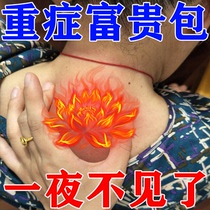 Special Metallurgy Rich bag dredged cervical spine special elimination post Metallurgical Therapy Neck Massage External Repair God Instrumental Paste XZ