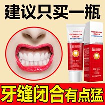 The tooth is wide and the repair artifact is closed as soon as the tooth is brushed. The repair artifact is sensitive to gum atrophy.