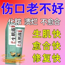 Wound healing fast scab removal of saprophytic muscle antibacterial external ointment old rotten legs diabetic foot pressure sores to promote muscle growth
