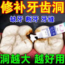 Fill Tooth hole paste Tooth Slit Repair Tooth Decay Yourself Fill Tooth hole Farewell to tooth Tooth Wormhole God yourself at home