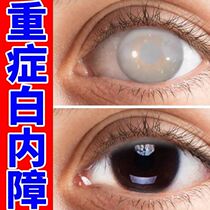 (One drop sees school) Cataract eye drops for the elderly imported from Japan with blurred vision cataract nemesis medicine