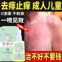 Heat prickly anti-itchy water adult go to prickly spray to remove the prickly heat cream anti-child disgizer Adult God Instrumental Powder liquid except