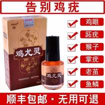 Remove the root of the corns the artifact the feet and the feet the Callus the wart the toe the chicken the wart.