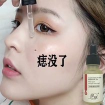 (Li Jiaqi recommends removing black spots on the face) White clean face black spots on the face men and women buy 2 get 1