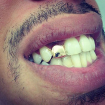 hiphop grillz gold - mounted hip hop jewelry single teeth with gold - edged hip hop dental set hollowed gold - hop