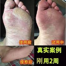 Lirong horse oil foot Shu cream 30g hands and feet cracked beriberi feet smelly feet peeling repair nourishing type buy 2 get 1