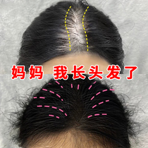 (Recommended by Li Jiaqi)Tongjitang Polygonum polygonum hair growth liquid Hair natural growth rate unisex
