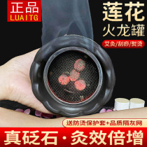 Stone Needle Moxibustion Jar Double Lotus Scraping Cup Fire Dragon Jar Shop With Large Number Purple Sand Moxibustion Palace Chill Fumigation Instrument