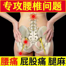 Nanjing Tongrentang wormwood lumbar spine stick lumbar disc protruding lumbar pain lumbar muscle strain sciatic pain buttock pain leg numbness