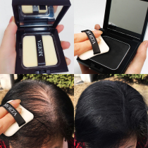  Hair replacement hair growth fiber artifact hair density increased hair volume hairline powder filling the top of the head rare baldness alopecia areata baldness