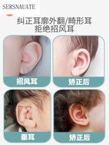 Baby ear correction correction device newborn baby auricle shaping paste baby anti-pressure wind magic device fixed silicone