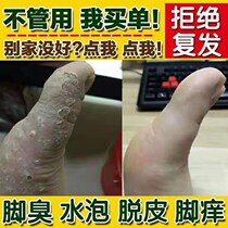 Four seasons foot health beriberi spray antipruritic cream Peeling sterilization Foot odor Foot itching Foot bubble type four rotten feet