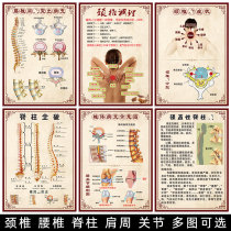Cervical spine picture frozen shoulder poster cervical spondylosis lumbar spine map bone hyperplasia wall stickers rich bag posters
