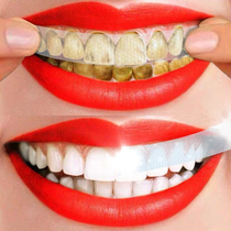 Whitening teeth quick-acting bright white yellowing beautiful white cleaning white cosmetic tooth yellow white artifact
